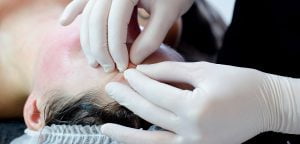 Just Skin - Amsterdam - rimpelreductietherapie | Litteken Reductie Therapie